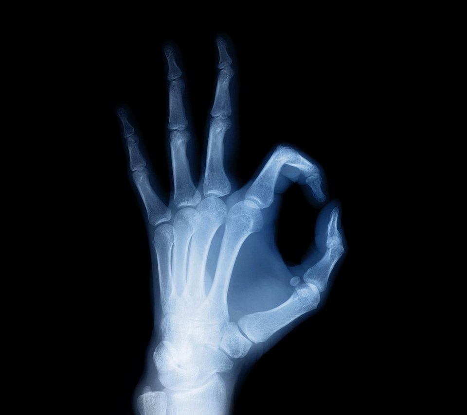 Обои рука, черный фон, рентген, кости, скелет, ок, hand, black background, x-ray, bones, skeleton, ok разрешение 1920x1200 Загрузить